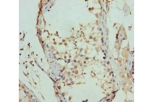 Immunohistochemistry of paraffin-embedded human testis tissue using ABIN7152449 at dilution of 1:100 (FBXO7 antibody  (AA 353-522))