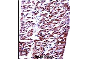 RM33 Antibody (C-term) ((ABIN657799 and ABIN2846772))immunohistochemistry analysis in formalin fixed and paraffin embedded human heart tissue followed by peroxidase conjugation of the secondary antibody and DAB staining. (MRPL33 antibody  (C-Term))