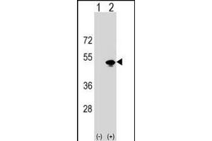 Western blot analysis of KRR1 (arrow) using rabbit polyclonal KRR1 Antibody (N-term) (ABIN1538757 and ABIN2848753). (KRR1 antibody  (N-Term))