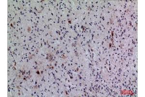 Immunohistochemistry (IHC) analysis of paraffin-embedded Human Brain, antibody was diluted at 1:100. (FGF5 antibody  (C-Term))