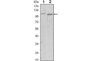 Western blot analysis using FAK mouse mAb against A549 (1) and NIH/3T3 (2) cell lysate. (FAK antibody)