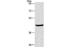 Western blot analysis of HT-29 cell, using GCK Polyclonal Antibody at dilution of 1:450 (GCK antibody)