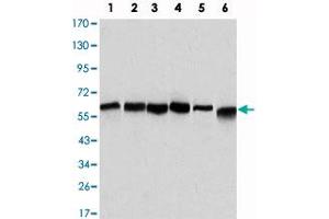 Western blot analysis using BECN1 monoclonal antibody, clone 2A4  against HeLa (1), A-431 (2), MCF-7 (3), Raji (4), Jurkat (5) and SK-BR-3 (6) cell lysate. (Beclin 1 antibody)