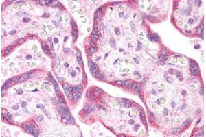 Human Placenta: Formalin-Fixed, Paraffin-Embedded (FFPE) (K-RAS antibody  (N-Term))