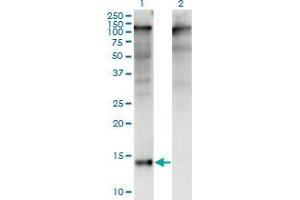 Western Blot analysis of ZBTB16 expression in transfected 293T cell line by ZBTB16 monoclonal antibody (M01), clone 3A7.