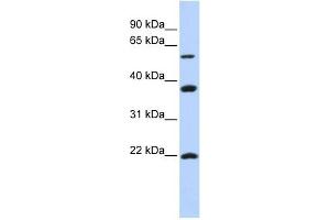 MYLIP antibody used at 1 ug/ml to detect target protein. (MYLIP antibody  (Middle Region))