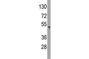 Western blot analysis of ILK antibody and HeLa lysate. (ILK antibody  (AA 225-253))