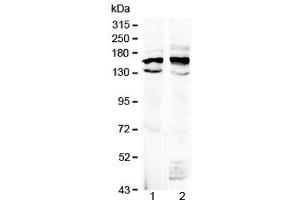 Western blot testing of 1) rat brain and 2) mouse brain lysate with Formin antibody at 0.