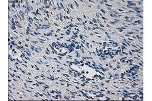 Immunohistochemical staining of paraffin-embedded liver tissue using anti-CYP2E1 mouse monoclonal antibody.
