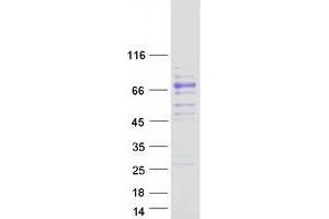 Validation with Western Blot (Coagulation Factor X Protein (F10) (Myc-DYKDDDDK Tag))