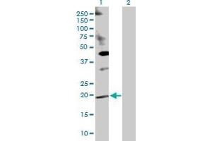 Lane 1: DUSP14 transfected lysate ( 22. (DUSP14 293T Cell Transient Overexpression Lysate(Denatured))