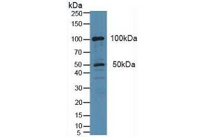 Western blot analysis of Human HeLa cells. (PLA2G4A antibody  (AA 1-178))