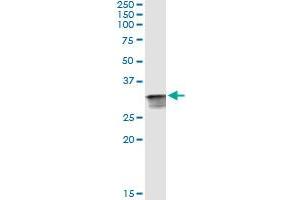Immunoprecipitation (IP) image for anti-Cyclin-Dependent Kinase 2 (CDK2) (AA 1-298) antibody (ABIN514270)