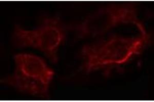 ABIN6272305 staining LOVO cells by IF/ICC.