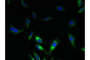 Immunofluorescent analysis of Hela cells using ABIN7169998 at dilution of 1:100 and Alexa Fluor 488-congugated AffiniPure Goat Anti-Rabbit IgG(H+L) (SLC17A3 antibody  (AA 1-125))