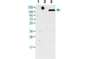 Western Blot (Cell lysate) analysis of Lane 1: RT-4 cell lysate, Lane 2: U-251MG cell lysate, Lane 3: Human plasma (IgG/HSA depleted) with LY75 polyclonal antibody .