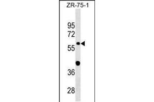 Western blot analysis in ZR-75-1 cell line lysates (35ug/lane). (GDPD2 antibody  (AA 305-334))