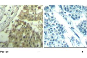 Image no. 1 for anti-Cyclin-Dependent Kinase 1 (CDK1) (Tyr19) antibody (ABIN319406) (CDK1 antibody  (Tyr19))