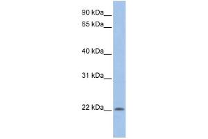 UBE2M Antikörper  (N-Term)