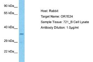 Host: Rabbit Target Name: OR7E24 Sample Type: 721_B Whole Cell lysates Antibody Dilution: 1. (OR7E24 antibody  (C-Term))