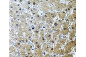 Immunohistochemistry of paraffin-embedded Human liver damage using RNF166 Polyclonal Antibody (RNF166 antibody)