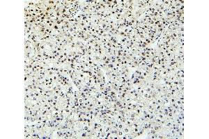 IHC analysis of PTBP2 using anti-PTBP2 antibody (ABIN7599452). (PTBP2 antibody  (AA 1-504))