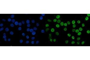 IF analysis of MCM6 using anti-MCM6 antibody (ABIN7600037).