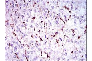 Immunohistochemistry (IHC) image for anti-Niemann-Pick Disease, Type C1 (NPC1) (AA 34-174) antibody (ABIN1845969)