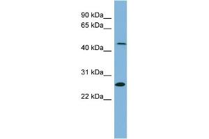 WB Suggested Anti-UPB1 Antibody Titration:  0. (UPB1 antibody  (Middle Region))