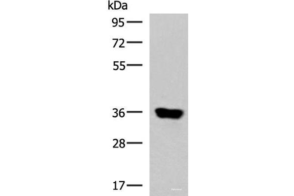 KCNK15 antibody