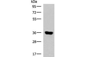 Western blot analysis of Human muscle tissue lysate using KCNK15 Polyclonal Antibody at dilution of 1:1000 (KCNK15 antibody)