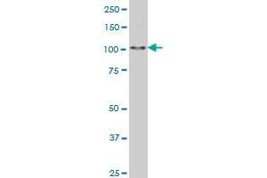 SALL4 monoclonal antibody (M03), clone 6E3 Western Blot analysis of SALL4 expression in Hela S3 NE . (SALL4 antibody  (AA 954-1053))