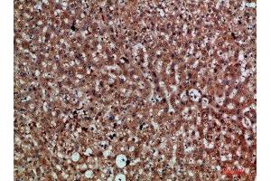 Immunohistochemical analysis of paraffin-embedded human-liver, antibody was diluted at 1:200 (CDNF antibody  (AA 31-80))