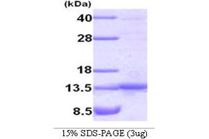 SDS-PAGE (SDS) image for TRAF Family Member-Associated NFKB Activator (TANK) (AA 1-119) protein (ABIN667036)