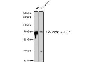 Western blot analysis of extracts of various cell lines, using Cytokeratin 2e (KRT2) antibody (ABIN6129540, ABIN6143025, ABIN6143026 and ABIN6214608) at 1:1000 dilution. (Keratin 2 antibody  (AA 1-220))