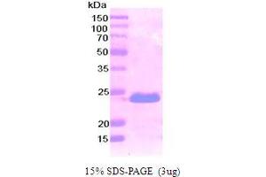 SDS-PAGE (SDS) image for Podoplanin (PDPN) (AA 99-207) protein (His tag) (ABIN667074) (Podoplanin Protein (PDPN) (AA 99-207) (His tag))