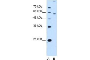 WB Suggested Anti-SLC22A2 Antibody Titration:  2. (SLC22A2 antibody  (N-Term))