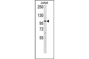 Image no. 1 for anti-DNA (Cytosine-5-)-Methyltransferase 3 alpha (DNMT3A) (N-Term) antibody (ABIN356568) (DNMT3A antibody  (N-Term))