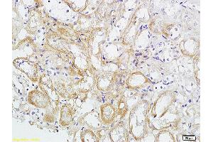 Formalin-fixed and paraffin embedded mouse kidney tissue labeled with Anti phospho-VEGFR2 (Tyr1175) Polyclonal Antibody, Unconjugated (ABIN746783) at 1:200 followed by conjugation to the secondary antibody and DAB staining (VEGFR2/CD309 antibody  (pTyr1175))