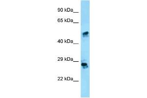 WB Suggested Anti-CRISP1 Antibody Titration: 1. (CRISP1 antibody  (N-Term))