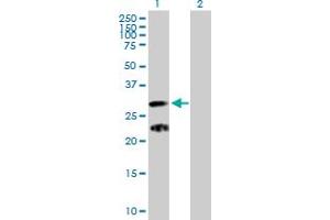 Western Blot analysis of C9orf152 expression in transfected 293T cell line by C9orf152 MaxPab polyclonal antibody. (C9orf152 antibody  (AA 1-218))
