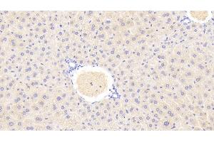 Detection of GLS2 in Mouse Liver Tissue using Polyclonal Antibody to Glutaminase 2 (GLS2) (GLS2 antibody  (AA 154-479))