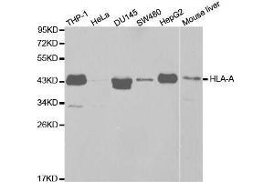 Western blot analysis of extracts of various cell lines, using HLA-A antibody. (HLA-A antibody  (AA 35-285))