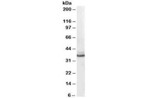 Western blot testing of human liver lysate with AKR1C4 antibody at 0. (AKR1C4 antibody)
