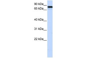 WB Suggested Anti-EWSR1 Antibody Titration:  0. (EWSR1 antibody  (Middle Region))