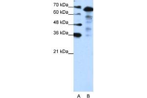 WB Suggested Anti-MLXIPL Antibody Titration:  1. (MLXIPL antibody  (N-Term))