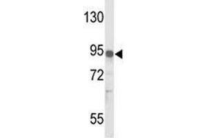 Western blot analysis of IL17RD antibody and MDA-MB231 lysate. (IL17RD antibody  (AA 217-245))