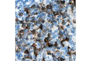 Immunohistochemical analysis of CDKL3 staining in human lymph node formalin fixed paraffin embedded tissue section.
