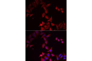 Immunofluorescence analysis of MCF7 cells using PCBD1 antibody. (PCBD1 antibody  (AA 1-104))