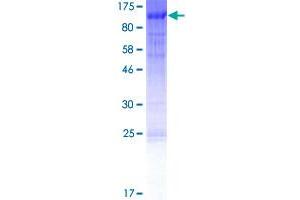 FOXN1 Protein (AA 1-648) (GST tag)